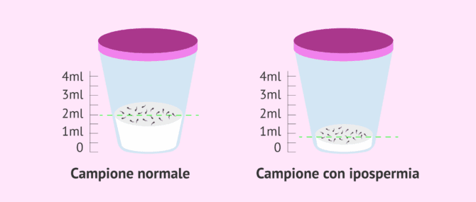 Imagen: Contenitore sterile per campioni