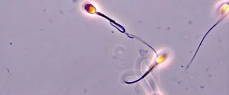 Spermatozoi