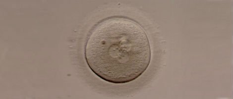 Embrione triploide inadatto