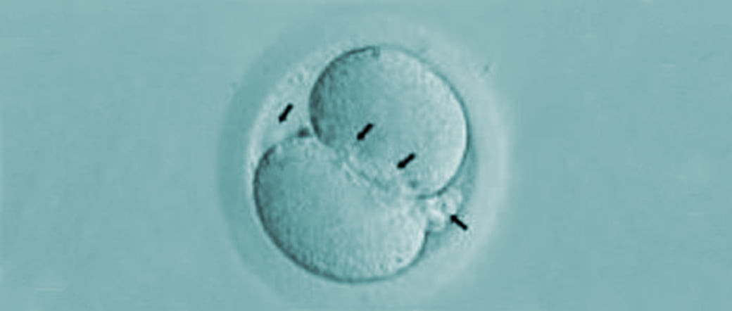 Embrioni grado II