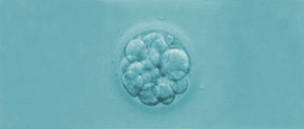 Embrioni grado IV