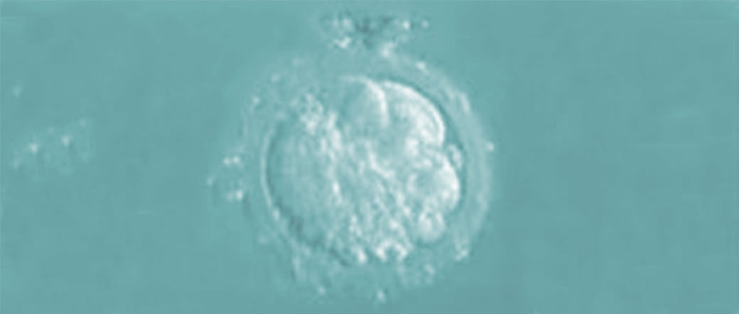 Embrioni grado V