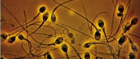 Avere un figlio con eiaculazione retrograda