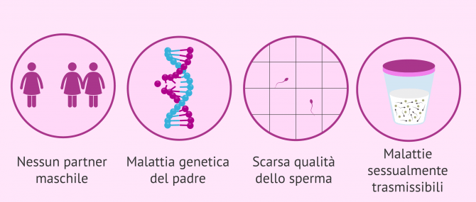 Imagen: Indicazione dell'IA