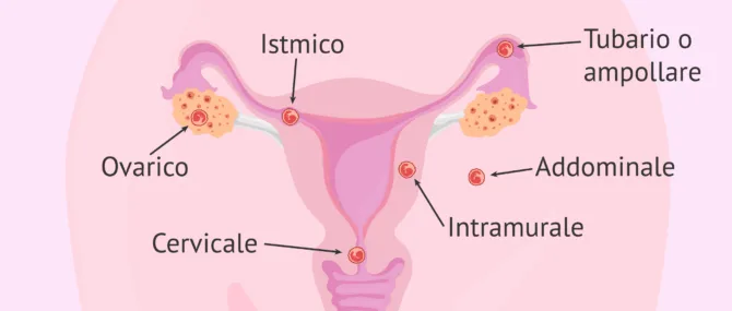 Imagen: Analisi di beta hCG