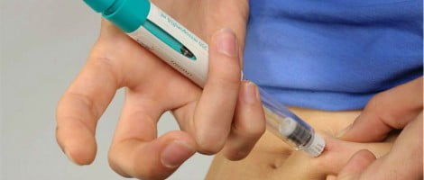 Induzione dell'ovulazione