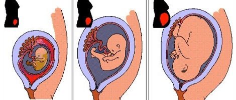 Posizione della cervice in gravidanza