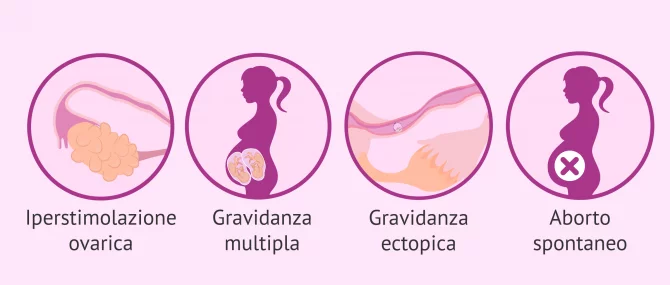 Imagen: Svantaggi dell'inseminazione artificiale: gestazione multipla.