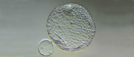 Embrione fuori dalla zona pellucida