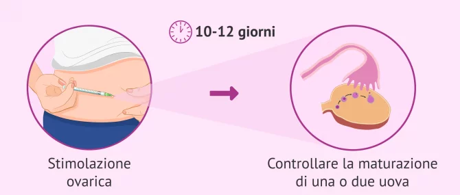 Imagen: Stimolazione ovarica per controllare la maturazione delle uova