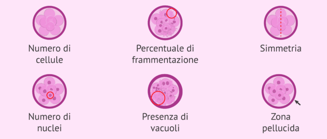 Imagen: Parametri per valutare la qualità embrionale