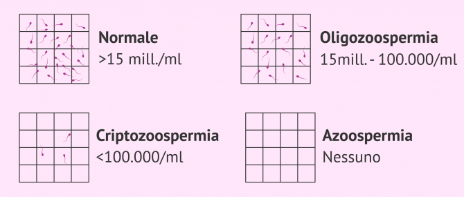 Imagen: Alterazioni della concentrazione seminale