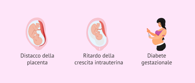 Imagen: Altri possibili rischi di diventare madre a più di 40 anni