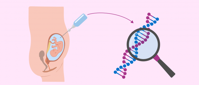 Imagen: Cos'è l'amniocentesi?