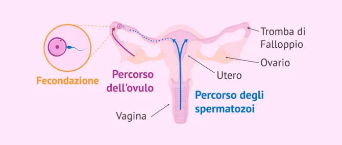 Imagen: Risalita degli spermatozoi verso le tube di Falloppio e fecondazione