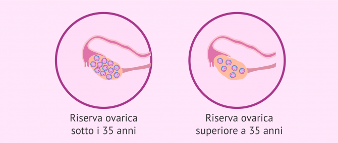 Imagen: La riserva ovarica e l'età della donna