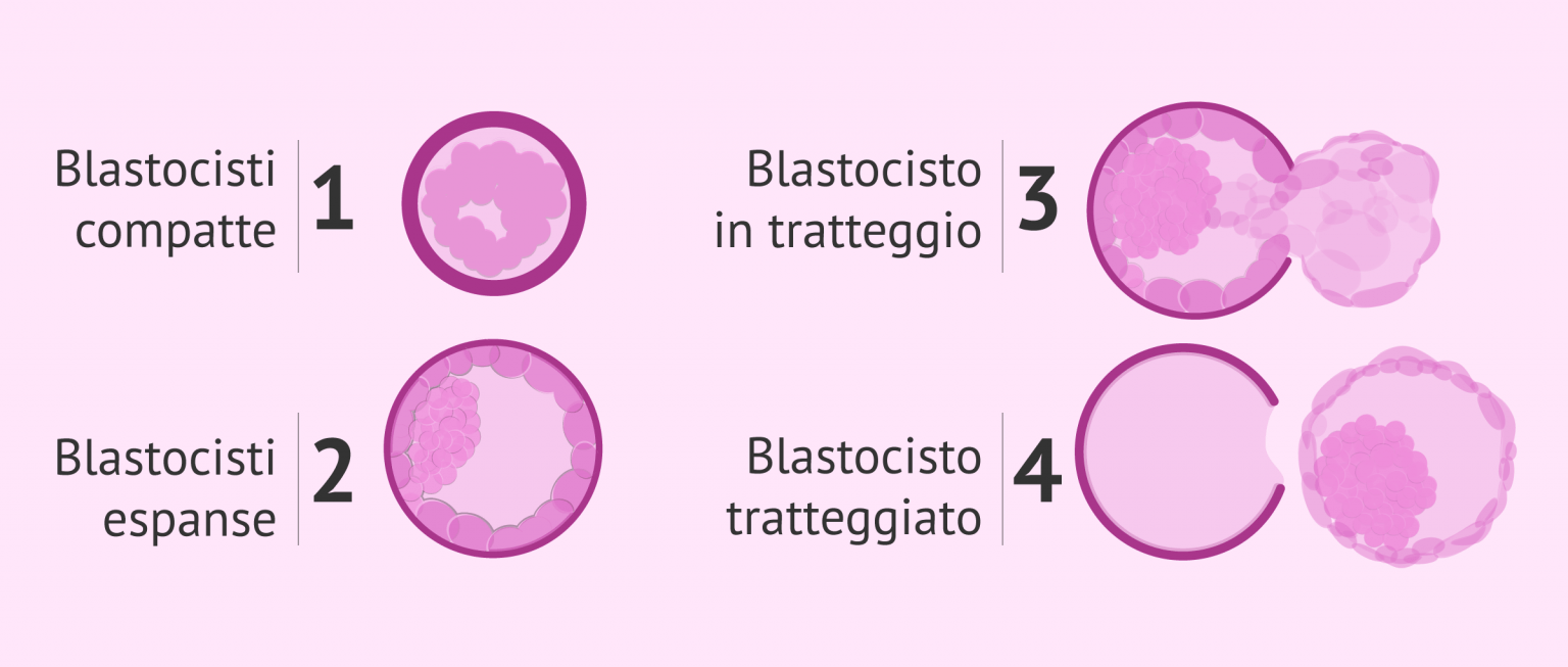 Blastocisti Espansa Di Un Percorso Di Pma