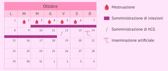 Imagen: Protocollo di SOC nell'inseminazione artificiale