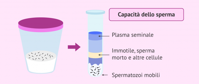 Imagen: Campione di sperma e capacitazione dello sperma