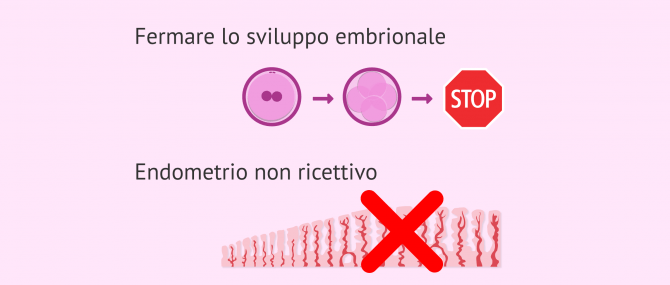 Imagen: Motivi per l'annullamento del trasferimento di embrioni