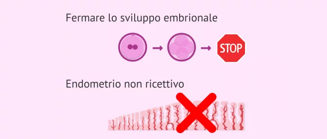 Imagen: Motivi per l'annullamento del trasferimento di embrioni