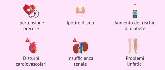 Imagen: Alterazioni associate alla sindrome di Turner