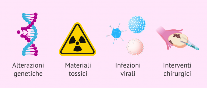 Imagen: Cause della menopausa precoce