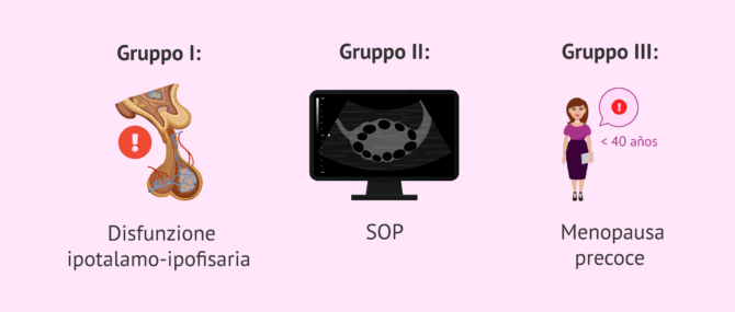 Imagen: Gruppi di classificazione delle cause dell'anovulazione prolungata