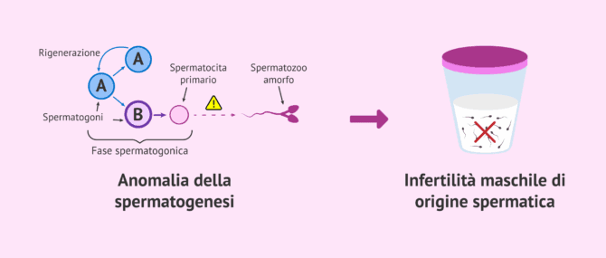 Imagen: Un errore nella spermatogenesi causa infertilità maschile