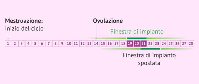 Imagen: Finestra di impianto e test ERA