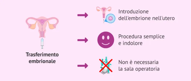 Imagen: Characteristics of embryo transfer