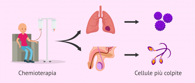Imagen: Chemioterapia e infertilità maschile