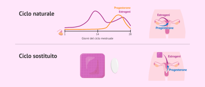 Imagen: Tipi di preparazione endometriale per il trasferimento di embrioni congelati
