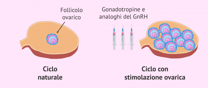 Imagen: Ciclo naturale e ciclo con stimolazione ovarica controllata