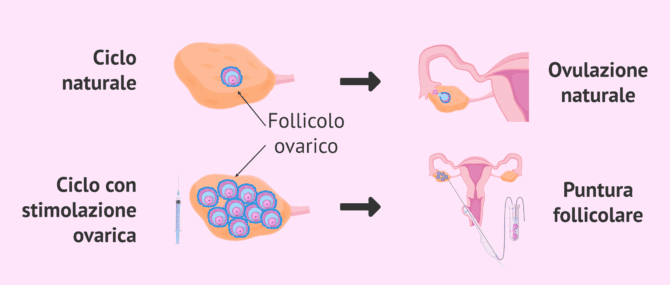Imagen: Ciclo naturale e ciclo stimolato nella donna