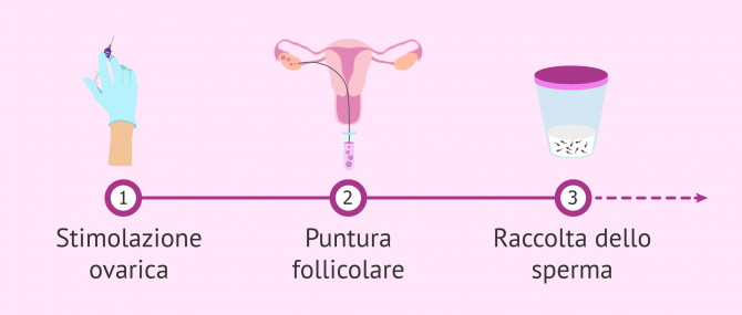 Imagen: Coltura embrionale en IVF