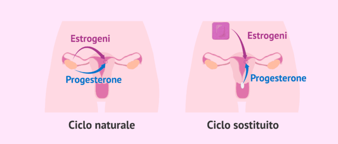 Imagen: Transfert embrionale in ciclo naturale o sostituito
