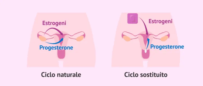 Imagen: Transfert embrionale in ciclo naturale o sostituito