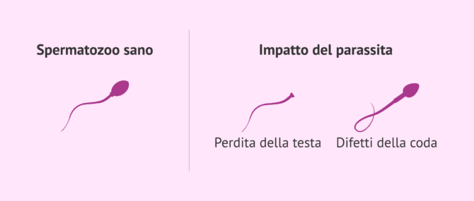 Imagen: Effetti della toxoplasmosi sugli spermatozoi