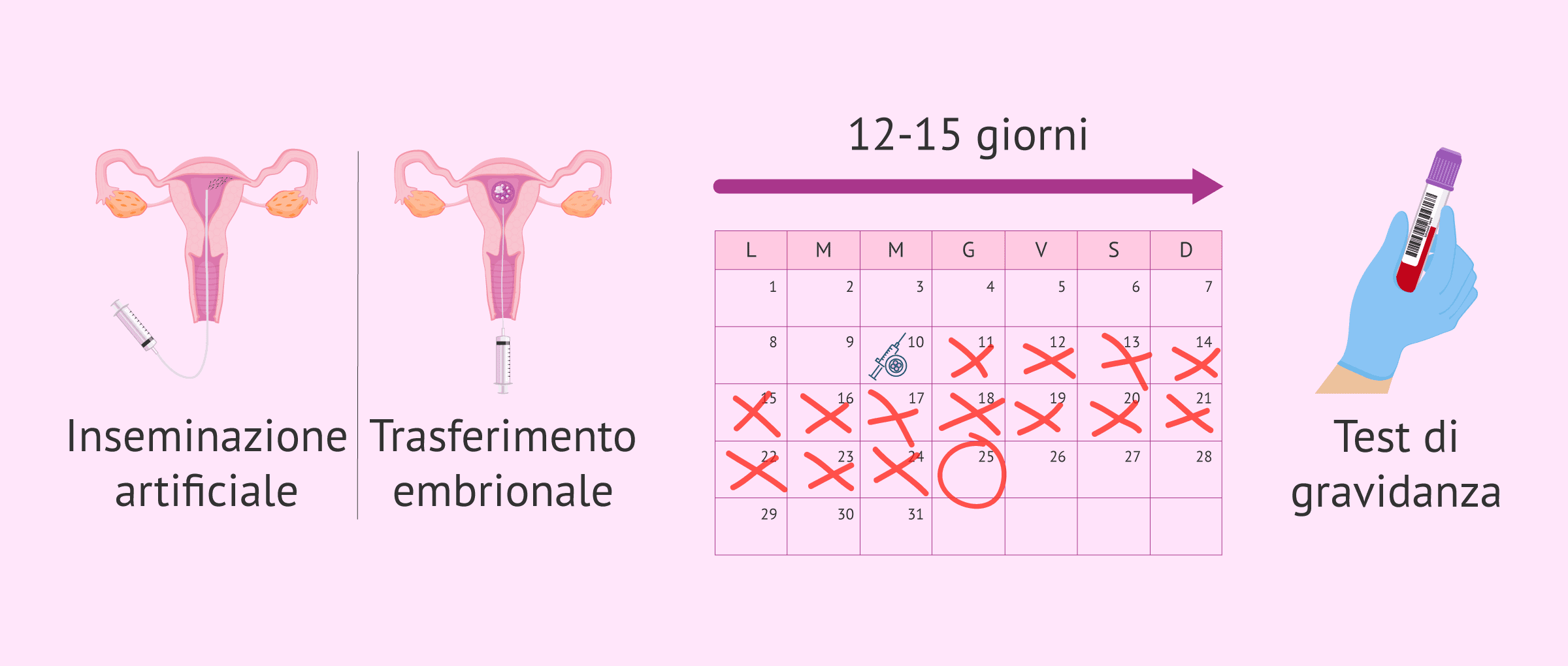 Imagen: Definizione di beta-attesa
