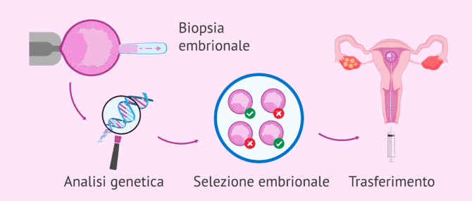 Imagen: PGT e selezione embrionale