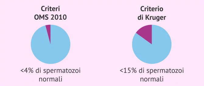 Imagen: Diagnosi di teratozoospermia