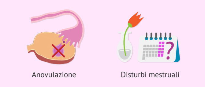 Imagen: Lievi problemi riproduttivi causati da ovaie policistiche