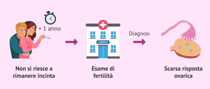 Imagen: Tempo di infertilità e bassa riserva ovarica