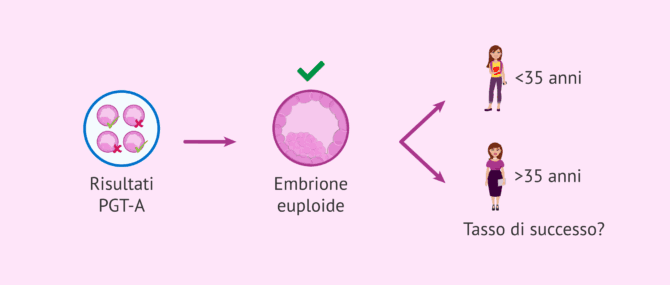 Imagen: L'età influisce sul successo del trasferimento di embrioni euploidi?
