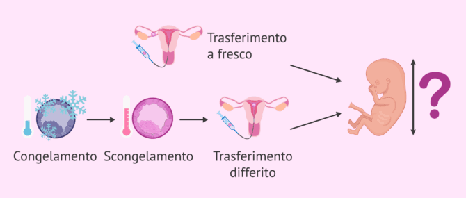 Imagen: Trasferimento a fresco o differito e crescita fetale