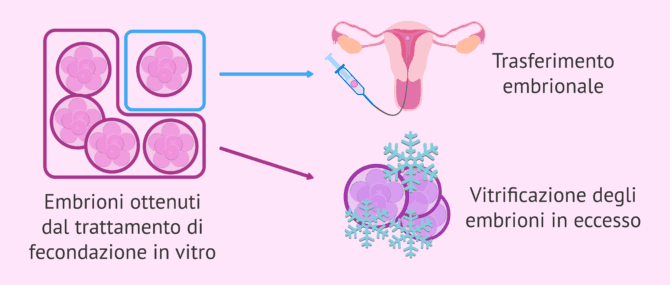 Imagen: Vitrificazione degli embrioni in sovrannumero