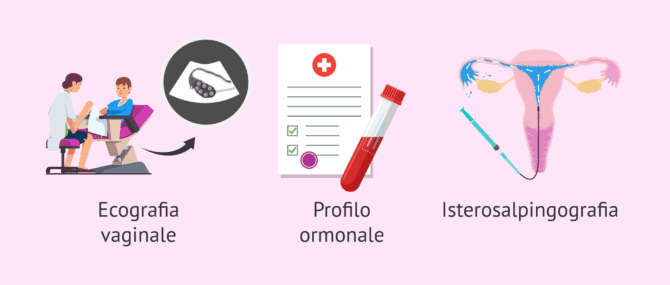 Imagen: Primi esami di fertilità nella donna