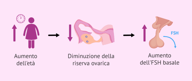Imagen: Diminuzione della riserva ovarica e aumento dell'FSH