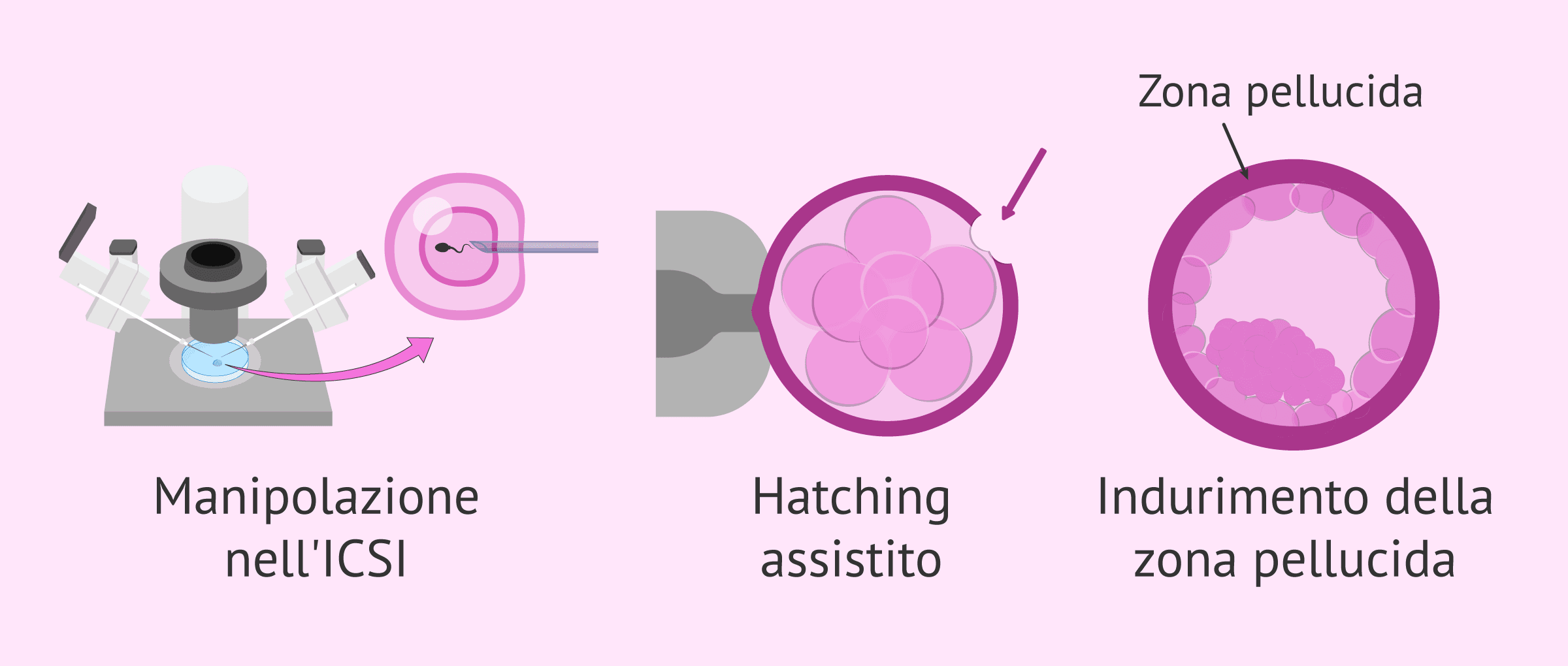 Imagen: Cosa influenza la probabilità di avere gemelli con la fecondazione in vitro?